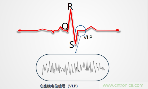 解決心電監(jiān)測行業(yè)難題，曼森伯格的濾波技術(shù)獲國家知識產(chǎn)權(quán)局發(fā)明授權(quán)